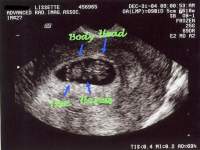 chichila15 chichila15