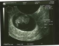 FinallyMrsB18 FinallyMrsB18