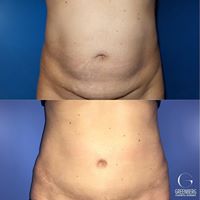 Greenberg Cosmetic Surgery