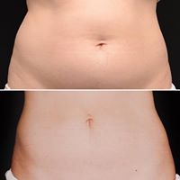 Greenberg Cosmetic Surgery