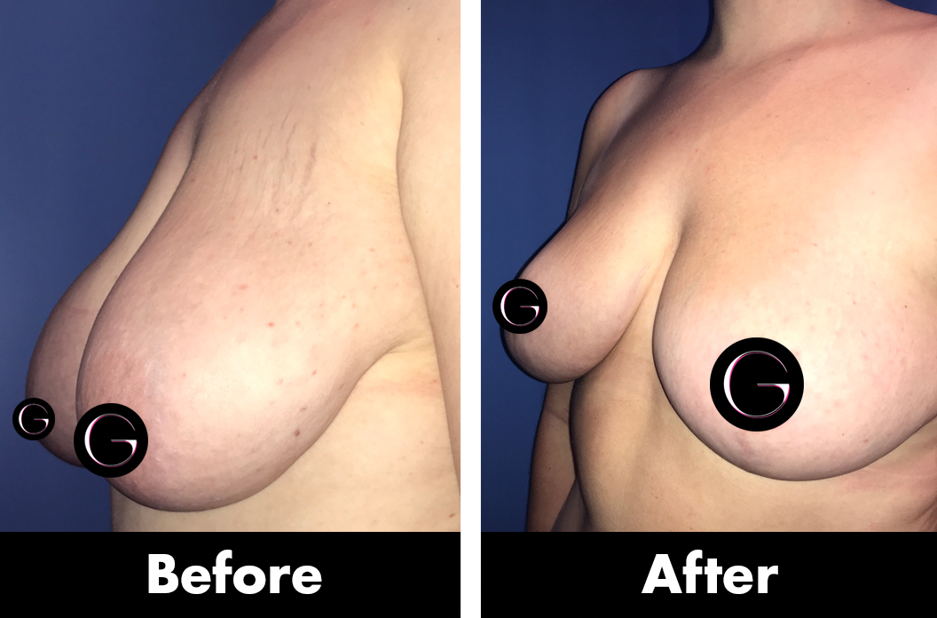 Greenberg Cosmetic Surgery