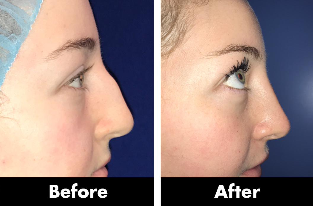 Greenberg Cosmetic Surgery