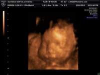 Csarelakos Csarelakos