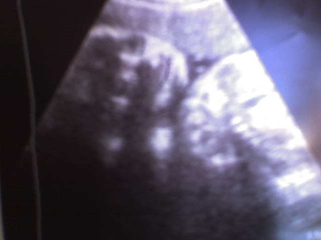 6839339_1.jpg