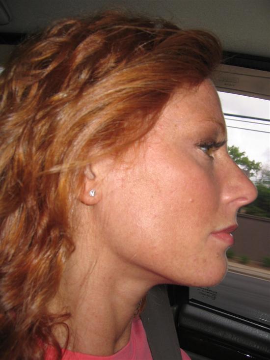 lredhead79