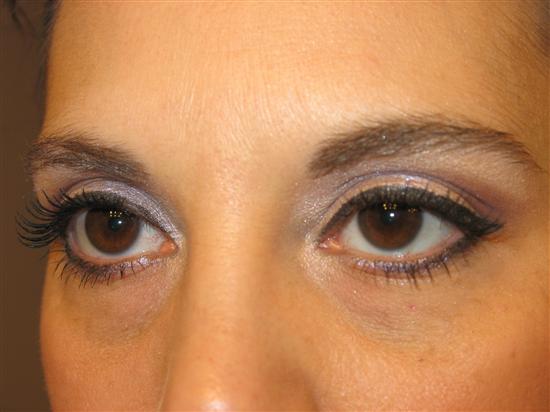 BAL5-9-05