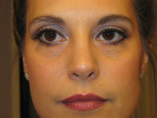 BAL5-9-05