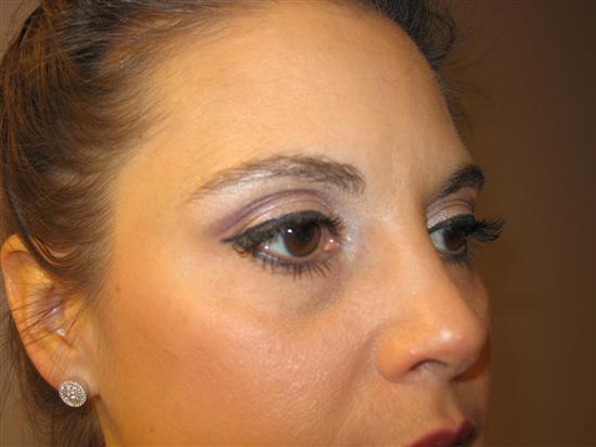 BAL5-9-05