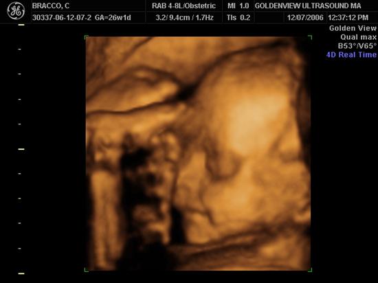 carolinebr